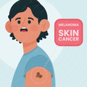 Genetic Testing for Melanoma: Assessing Your Risk